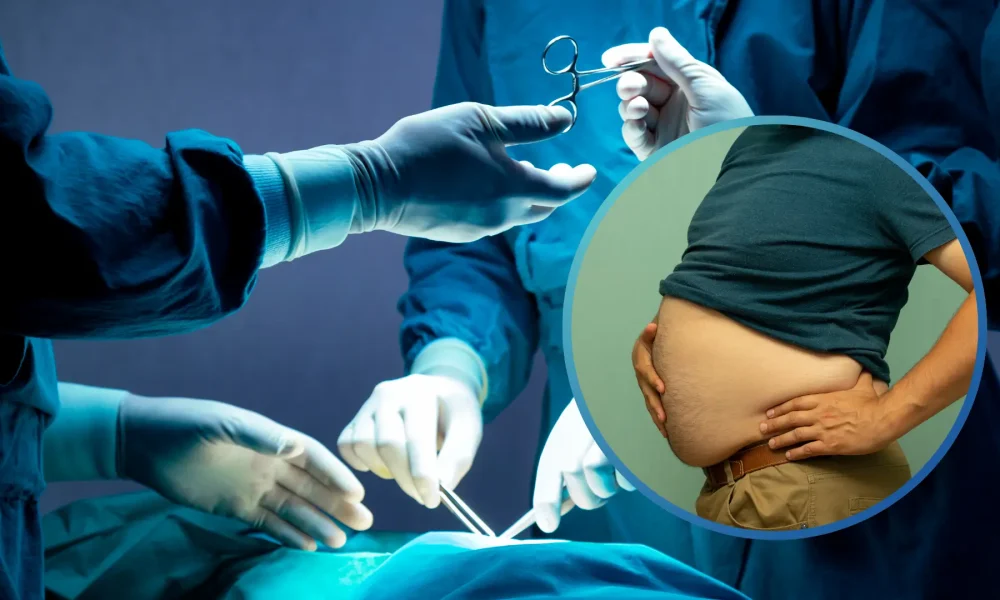 Obesity-Surgery-in-Turkey